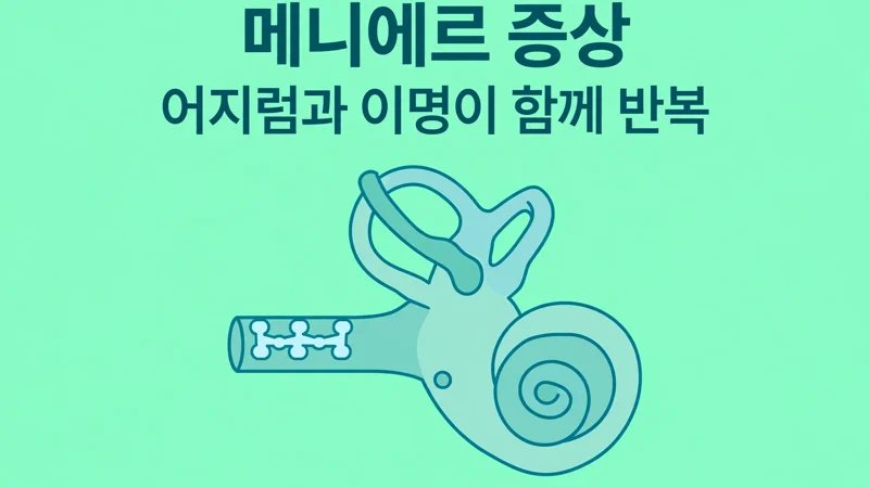 메니에르 증상